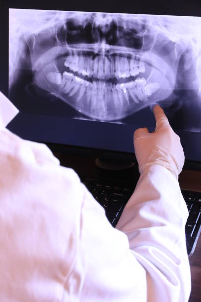Best Dental Abscess Treatment in Joseph, OR